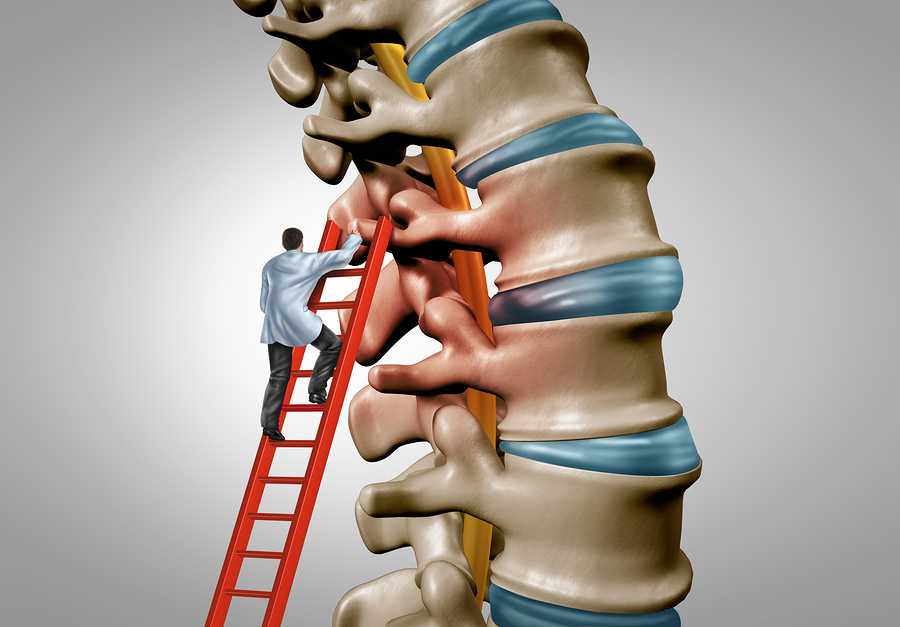 Physician Partners of America laser spine procedures allow a doctor to get to the root of spine pain
